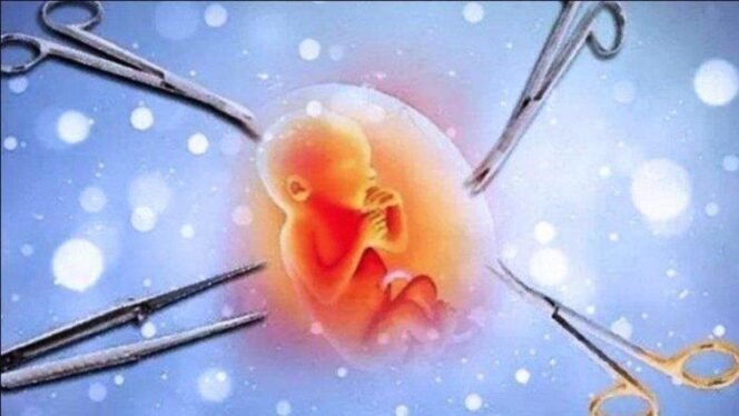 
 PENAFSIRAN AYAT-AYAT AHKAM TENTANG ABORSI